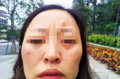 分手之后如何挽回处女座? 分手之后如何挽回处女座?